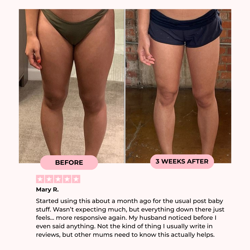 Avora™ Thigh & Pelvic Trainer